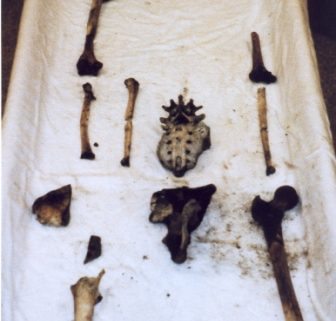 Sexing Skeletal Remains